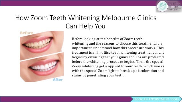 does zoom whitening hurt does zoom whitening hurt