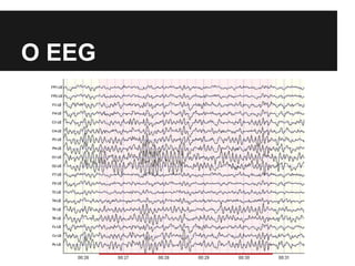 O EEG
 
