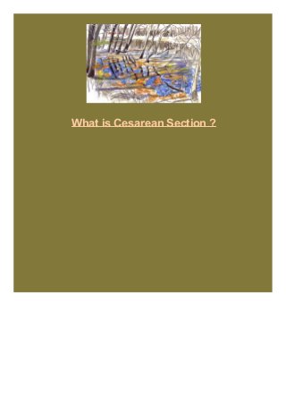 What is Cesarean Section ?

 