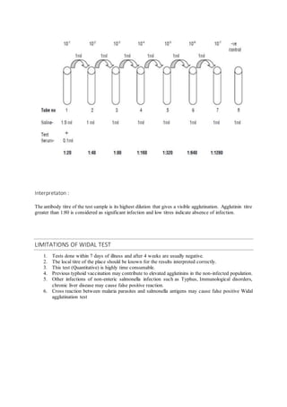 Widal Test Normal Value Widal test | DOCX