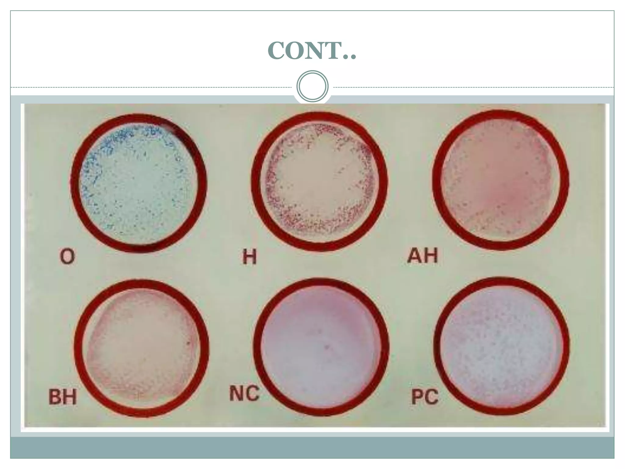 Widal Test Normal Value widal test. | PPTX