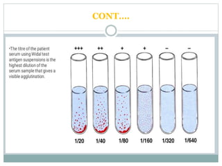 Widal Test Normal Value widal test. | PPTX
