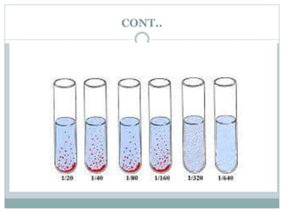 Widal Test Normal Value widal test. | PPTX