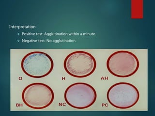 Interpretation
 Positive test: Agglutination within a minute.
 Negative test: No agglutination.
 