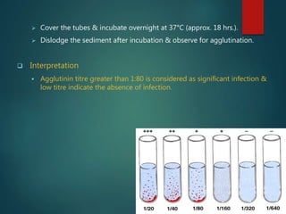 Cover the tubes & incubate overnight at 37°C (approx. 18 hrs.).
 Dislodge the sediment after incubation & observe for agglutination.
 Interpretation
 Agglutinin titre greater than 1:80 is considered as significant infection &
low titre indicate the absence of infection.
 
