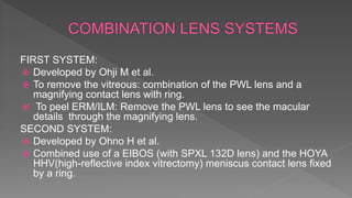 FIRST SYSTEM:
 Developed by Ohji M et al.
 To remove the vitreous: combination of the PWL lens and a
magnifying contact lens with ring.
 To peel ERM/ILM: Remove the PWL lens to see the macular
details through the magnifying lens.
SECOND SYSTEM:
 Developed by Ohno H et al.
 Combined use of a EIBOS (with SPXL 132D lens) and the HOYA
HHV(high-reflective index vitrectomy) meniscus contact lens fixed
by a ring.
 