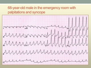 68-year-old male in the emergency room with
palpitations and syncope
 