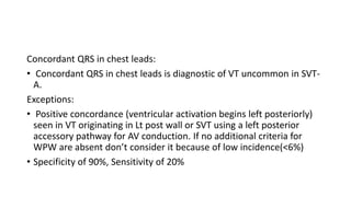 Concordant QRS in chest leads:
• Concordant QRS in chest leads is diagnostic of VT uncommon in SVT-
A.
Exceptions:
• Positive concordance (ventricular activation begins left posteriorly)
seen in VT originating in Lt post wall or SVT using a left posterior
accessory pathway for AV conduction. If no additional criteria for
WPW are absent don’t consider it because of low incidence(<6%)
• Specificity of 90%, Sensitivity of 20%
 