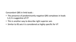 Concordant QRS in limb leads :
• The presence of predominantly negative QRS complexes in leads
1,2,3 is suggestive of VT
• This is another way to describe right superior axis
• Similar to RS axis it is considered as highly specific for VT
 