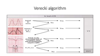Verecki algorithm
 