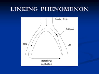 LINKING PHENOMENON
 