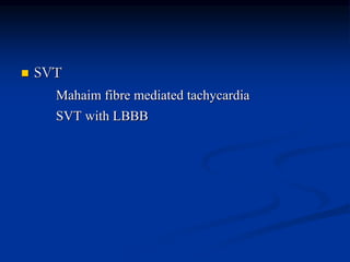  SVT
Mahaim fibre mediated tachycardia
SVT with LBBB
 