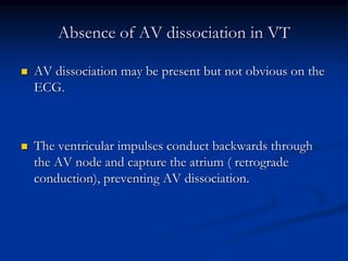Absence of AV dissociation in VT
 AV dissociation may be present but not obvious on the
ECG.
 The ventricular impulses conduct backwards through
the AV node and capture the atrium ( retrograde
conduction), preventing AV dissociation.
 