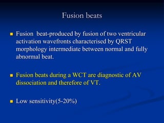 Fusion beats
 Fusion beat-produced by fusion of two ventricular
activation wavefronts characterised by QRST
morphology intermediate between normal and fully
abnormal beat.
 Fusion beats during a WCT are diagnostic of AV
dissociation and therefore of VT.
 Low sensitivity(5-20%)
 