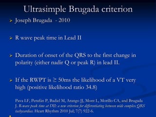 Ultrasimple Brugada criterion
 Joseph Brugada - 2010
 R wave peak time in Lead II
 Duration of onset of the QRS to the first change in
polarity (either nadir Q or peak R) in lead II.
 If the RWPT is ≥ 50ms the likelihood of a VT very
high (positive likelihood ratio 34.8)
Pava LF, Perafán P, Badiel M, Arango JJ, Mont L, Morillo CA, and Brugada
J. R-wave peak time at DII: a new criterion for differentiating between wide complex QRS
tachycardias. Heart Rhythm 2010 Jul; 7(7) 922-6.
 