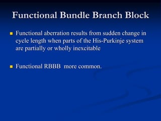 Functional Bundle Branch Block
 Functional aberration results from sudden change in
cycle length when parts of the His-Purkinje system
are partially or wholly inexcitable
 Functional RBBB more common.
 