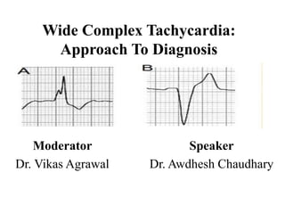 Wide Complex Tachycardia:
Approach To Diagnosis
Moderator
Dr. Vikas Agrawal
Speaker
Dr. Awdhesh Chaudhary
 
