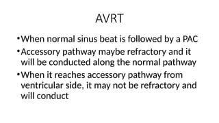 Wide complex Wide Complex Tachycardias.pptx