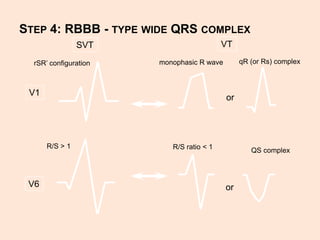 wide-complex-tacycardia-pptx