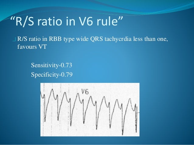 Wide complex Tachycardia by Dr. Vaibhav Yawalkar