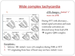Avr Terminal R Wave WIDE QRS TACHYCARDIA | PPT