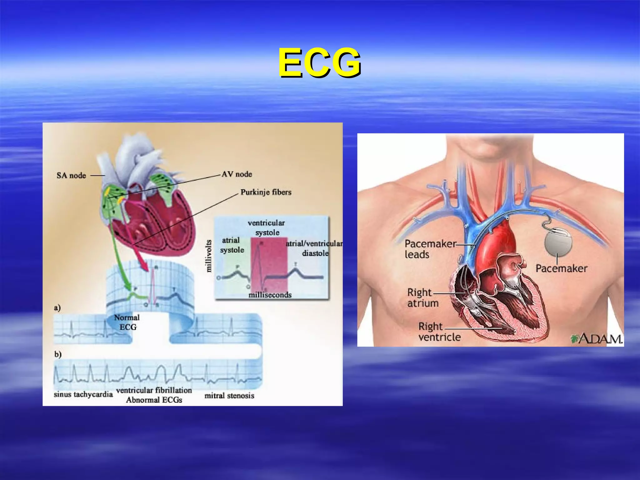 ECG 