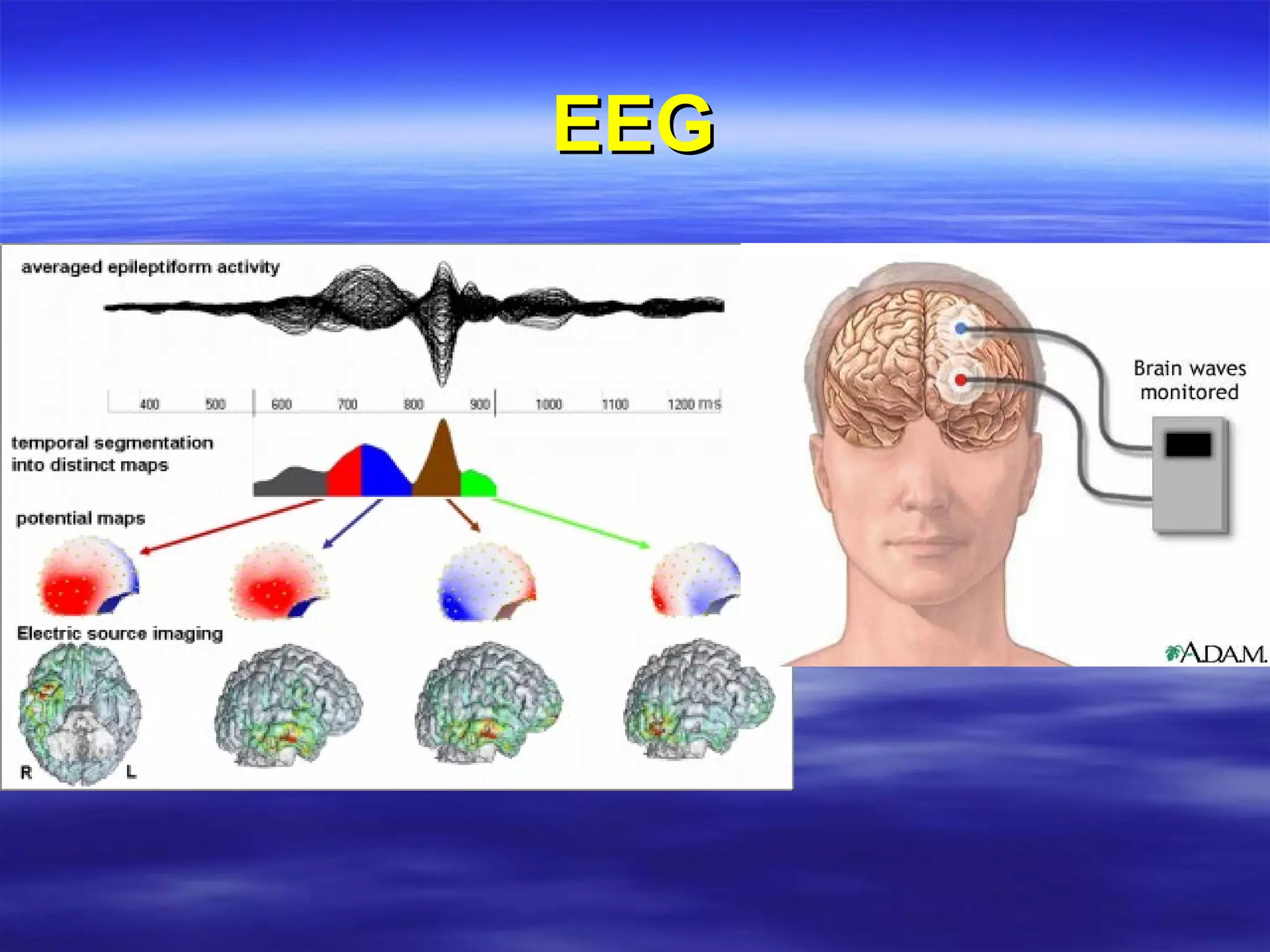 EEG 