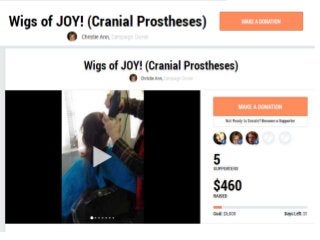 Wigs of joy - Bringing joy and life back to women and children