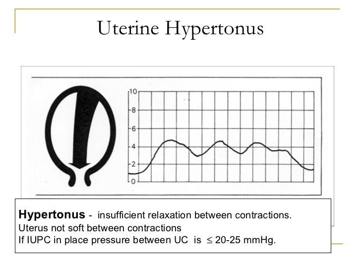 Wiki.assessment of uterine contractions 2011