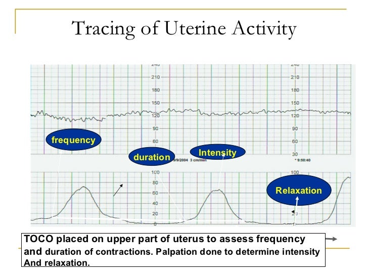 Wiki.assessment of uterine contractions 2011