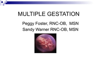 MULTIPLE GESTATION
 Peggy Foster, RNC-OB, MSN
 Sandy Warner RNC-OB, MSN
 