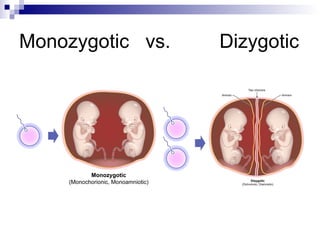 Monozygotic vs.   Dizygotic
 