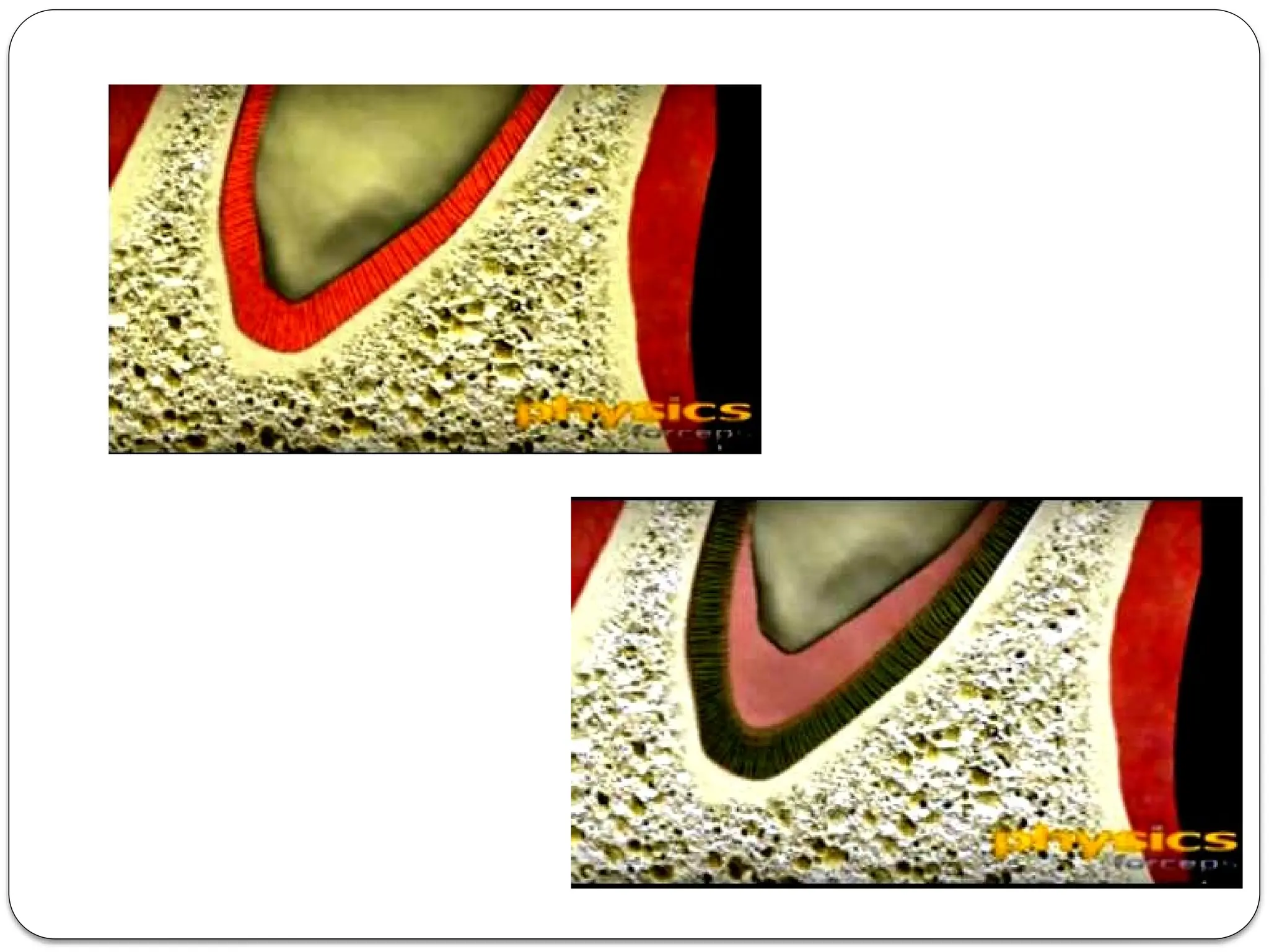 Wilckodontics the art of atraumatic extraction of tooth | PPTX