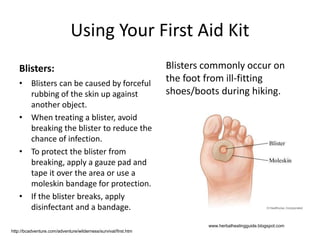 Using Your First Aid Kit
Blisters:
• Blisters can be caused by forceful
rubbing of the skin up against
another object.
• When treating a blister, avoid
breaking the blister to reduce the
chance of infection.
• To protect the blister from
breaking, apply a gauze pad and
tape it over the area or use a
moleskin bandage for protection.
• If the blister breaks, apply
disinfectant and a bandage.
Blisters commonly occur on
the foot from ill-fitting
shoes/boots during hiking.
www.herbalhealingguide.blogspot.com
http://bcadventure.com/adventure/wilderness/survival/first.htm
 