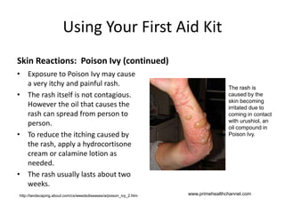 Using Your First Aid Kit
Skin Reactions: Poison Ivy (continued)
• Exposure to Poison Ivy may cause
a very itchy and painful rash.
• The rash itself is not contagious.
However the oil that causes the
rash can spread from person to
person.
• To reduce the itching caused by
the rash, apply a hydrocortisone
cream or calamine lotion as
needed.
• The rash usually lasts about two
weeks.
The rash is
caused by the
skin becoming
irritated due to
coming in contact
with urushiol, an
oil compound in
Poison Ivy.
www.primehealthchannel.comhttp://landscaping.about.com/cs/weedsdiseases/a/poison_ivy_2.htm
 