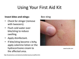 Using Your First Aid Kit
Insect bites and stings:
• Check for stinger (remove
with tweezers).
• Flush cold water over
bite/sting to reduce
swelling.
• Apply disinfectant.
• If bite/sting become s itchy,
apply calamine lotion or the
hydrocortisone cream to
the affected area.
Bee sting
http://bcadventure.com/adventure/wilderness/survival/first.htm
www.buzzle.com
 