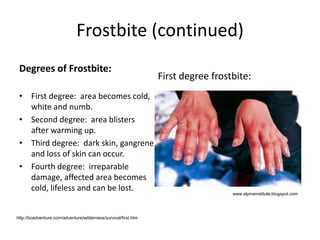 Frostbite (continued)
Degrees of Frostbite:
• First degree: area becomes cold,
white and numb.
• Second degree: area blisters
after warming up.
• Third degree: dark skin, gangrene
and loss of skin can occur.
• Fourth degree: irreparable
damage, affected area becomes
cold, lifeless and can be lost.
First degree frostbite:
www.alpineinstitute.blogspot.com
http://bcadventure.com/adventure/wilderness/survival/first.htm
 
