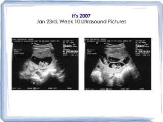 It's 2007 Jan 23rd, Week 10 Ultrasound Pictures 