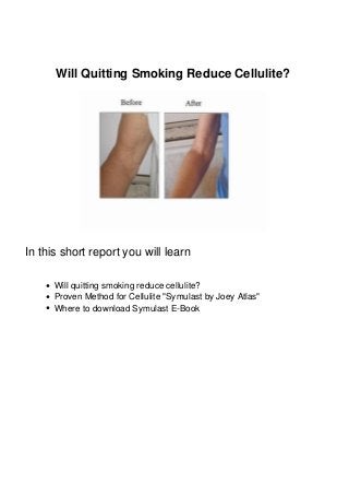 Will Quitting Smoking Reduce Cellulite?
In this short report you will learn
Will quitting smoking reduce cellulite?
Proven Method for Cellulite "Symulast by Joey Atlas"
Where to download Symulast E-Book
 