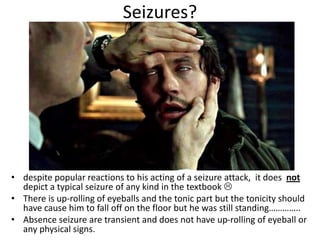 Seizures?
• despite popular reactions to his acting of a seizure attack, it does not
depict a typical seizure of any kind in the textbook 
• There is up-rolling of eyeballs and the tonic part but the tonicity should
have cause him to fall off on the floor but he was still standing…………..
• Absence seizure are transient and does not have up-rolling of eyeball or
any physical signs.
 