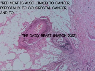“red meat is also linked to cancer,
especially to Colorectal Cancer,
and to...”




                                                   - The Daily Beast (March 2012)




Image: Patho: http://commons.wikimedia.org/wiki/File:Tumor_invasion_into_vein_in_a_case_of_colorectal_cancer,_Elastica_stain_1.jpg
 
