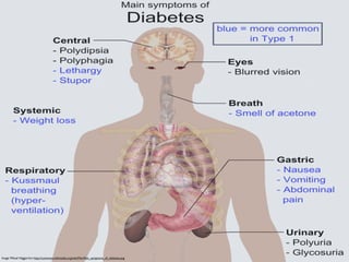 Image: Mikael Häggström: http://commons.wikimedia.org/wiki/File:Main_symptoms_of_diabetes.png
 