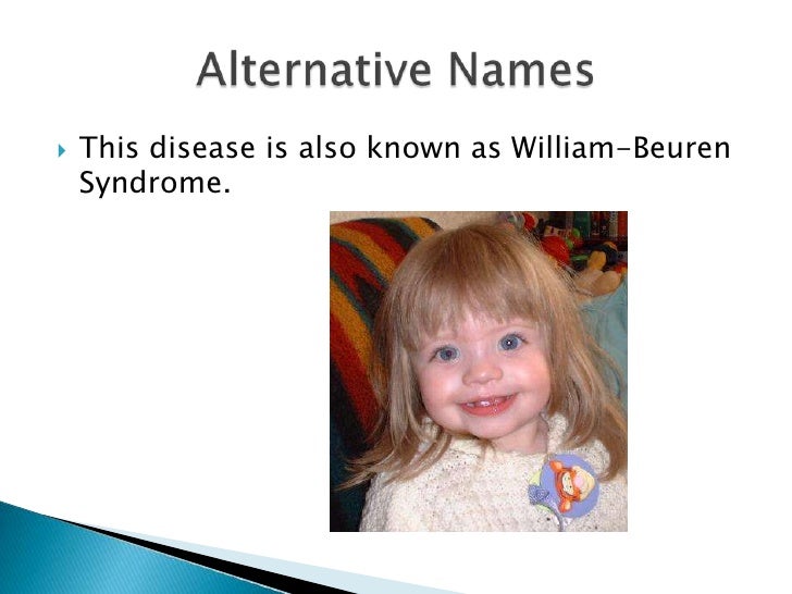 Goede Williams Syndrome UP-36