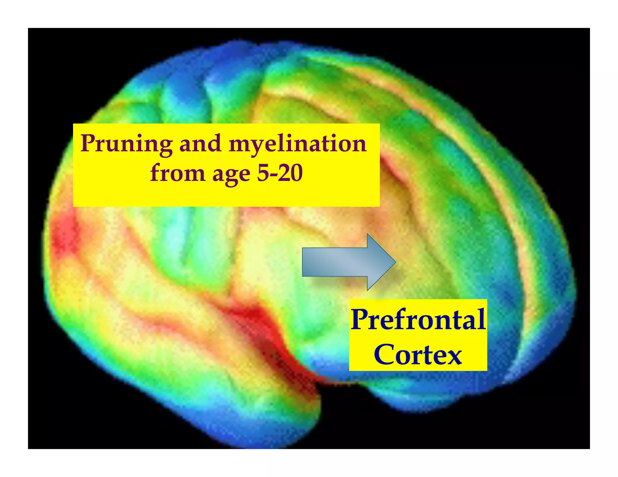 Prun
                             Prefrontal
                              Cortex


Pruning and myelination
     from age 5-20




                     Prefrontal
                      Cortex
 