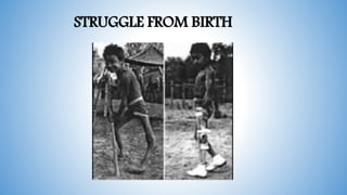 STRUGGLE FROM BIRTH
 