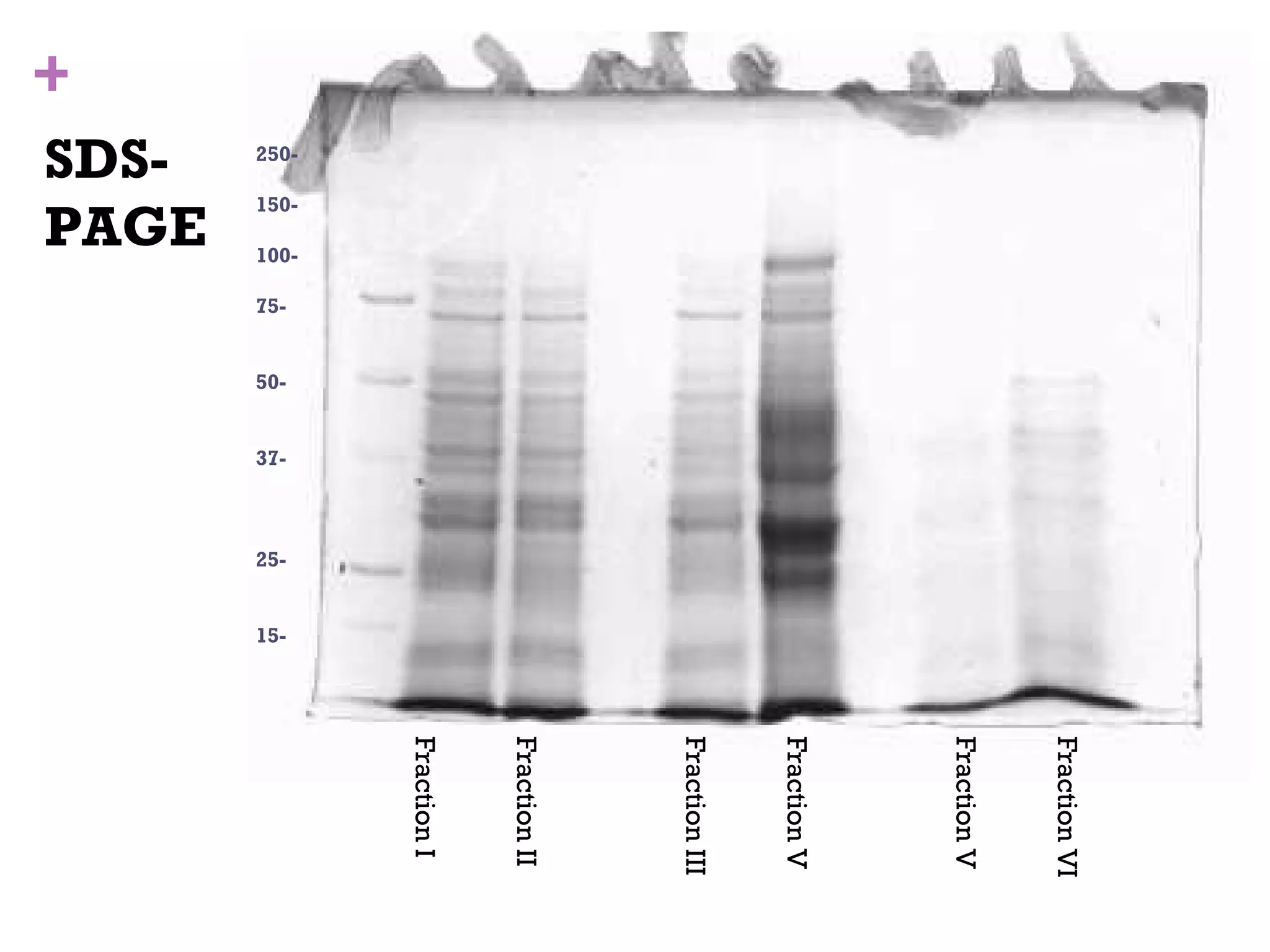 Fraction VI
                                                       Fraction V
                                                       Fraction V
                                                       Fraction III
                                                       Fraction II
                                                       Fraction I
    250-

           150-

                  100-

                         75-


                               50-


                                     37-



                                           25-


                                                 15-
    PAGE
    SDS-
+
 