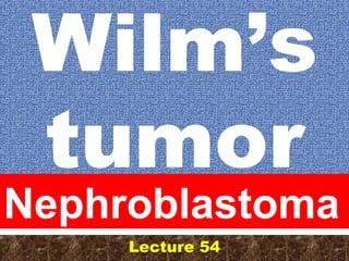 Wilm’s
tumor

Nephroblastoma
Lecture 54

 
