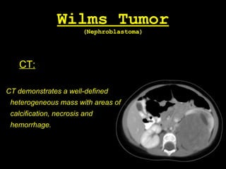 Wilms Tumor
(Nephroblastoma)
CT:
CT demonstrates a well-defined
heterogeneous mass with areas of
calcification, necrosis and
hemorrhage.
 