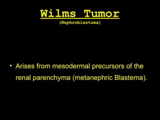 Wilms Tumor
(Nephroblastoma)
• Arises from mesodermal precursors of the
renal parenchyma (metanephric Blastema).
 
