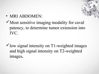 • MRI ABDOMEN:
Most sensitive imaging modality for caval
patency, to determine tumor extension into
IVC.
low signal intensity on T1-weighted images
and high signal intensity on T2-weighted
images.
 